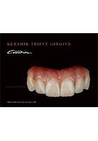 Keramik triff Gingiva