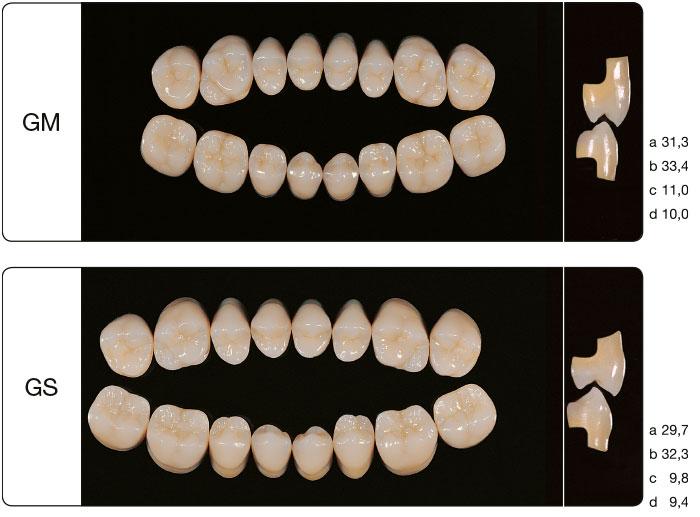L'utilisation de différents types de dents artificielles